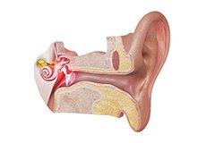 Ear Infection